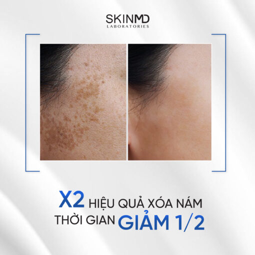 SKINMD PURE WHITENOL SERUM - Hình ảnh 7