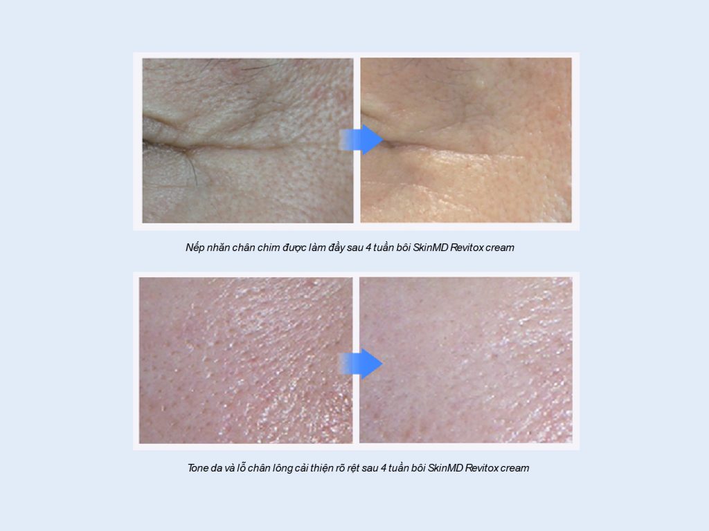 Kem lão hóa Skinmd Revitox Peptide 