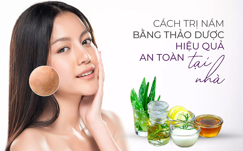 cách trị nám bằng thảo dược jeju