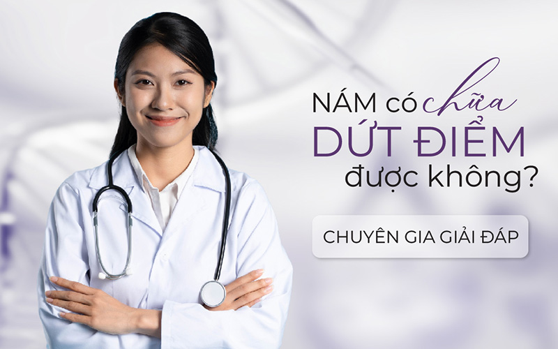 Nám có chữa dứt điểm được không