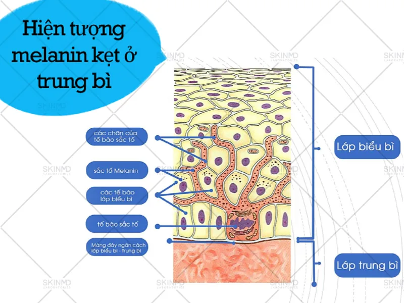 nám kháng trị do đâu 