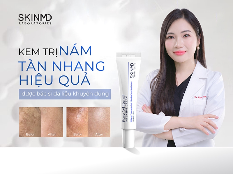kem trị nám tàn nhang hiệu quả