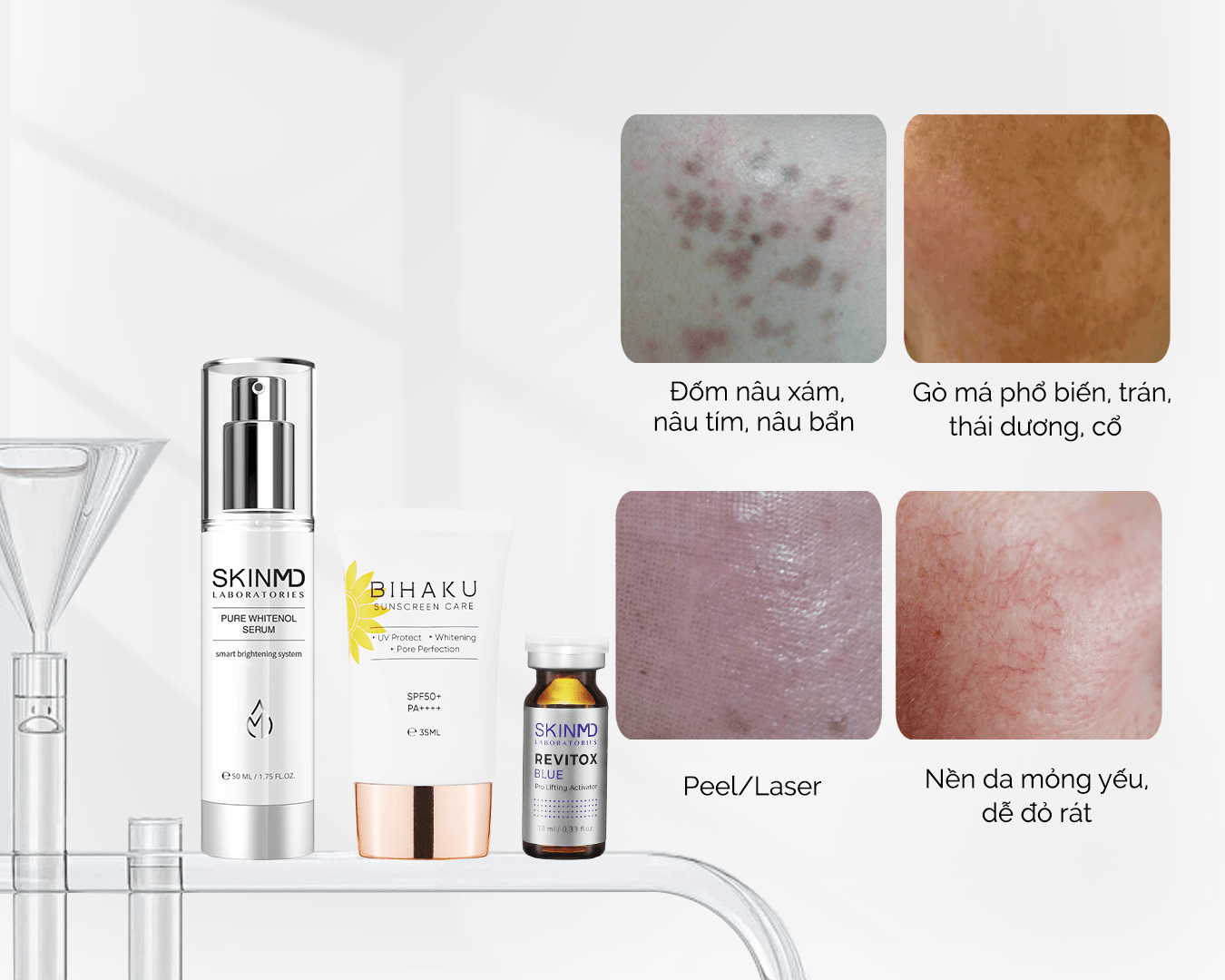 Phát hiện nám không khó cái khó là chưa có một phác đồ điều trị đúng cách