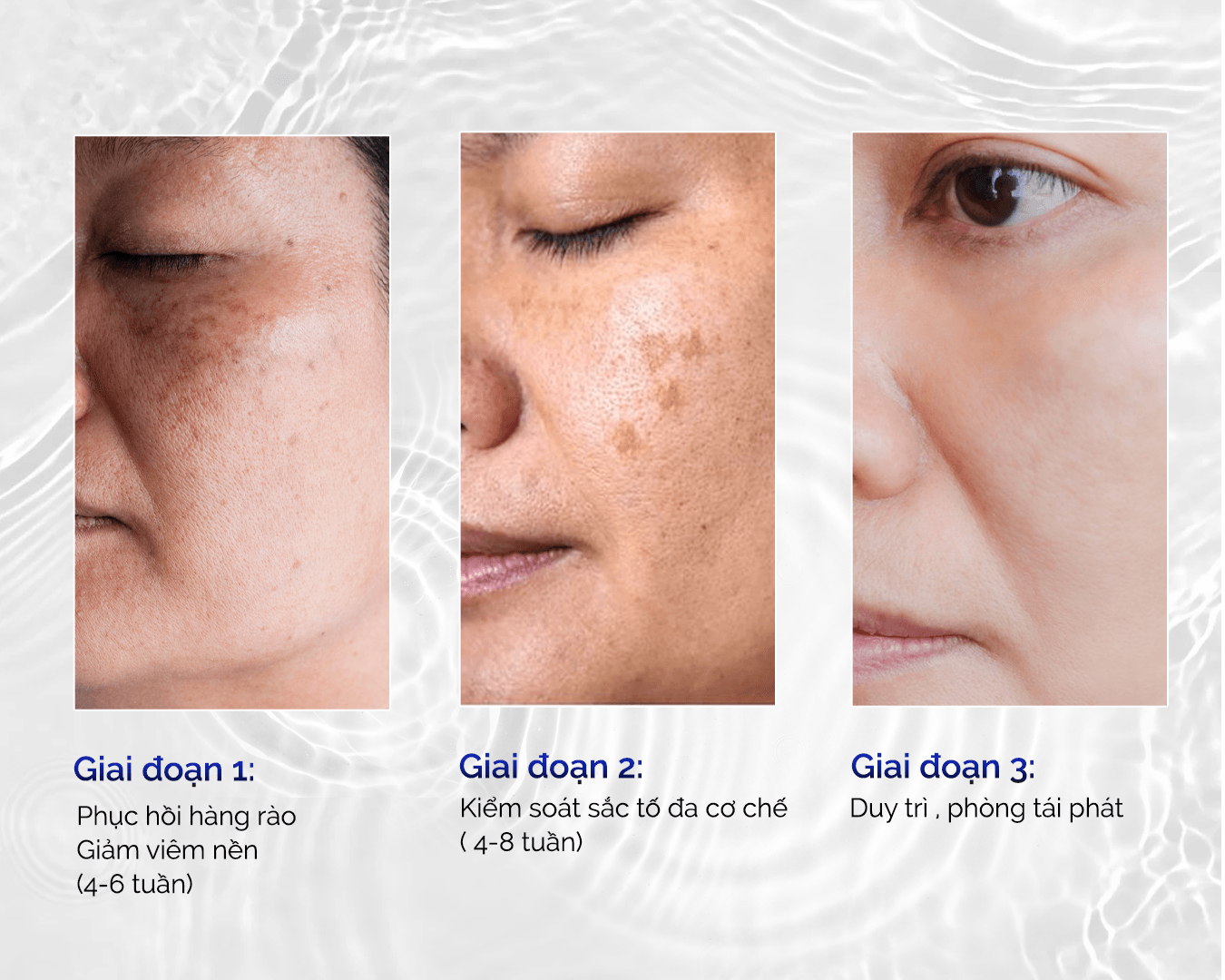 SkinMD giúp phục hồi nền da kiểm soát sắc tố đồng thời chống tái phát nám