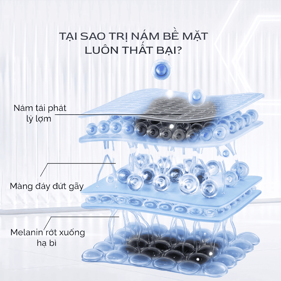 Cơ chế hình thành nám da và các yếu tố kích thích sản sinh melanin