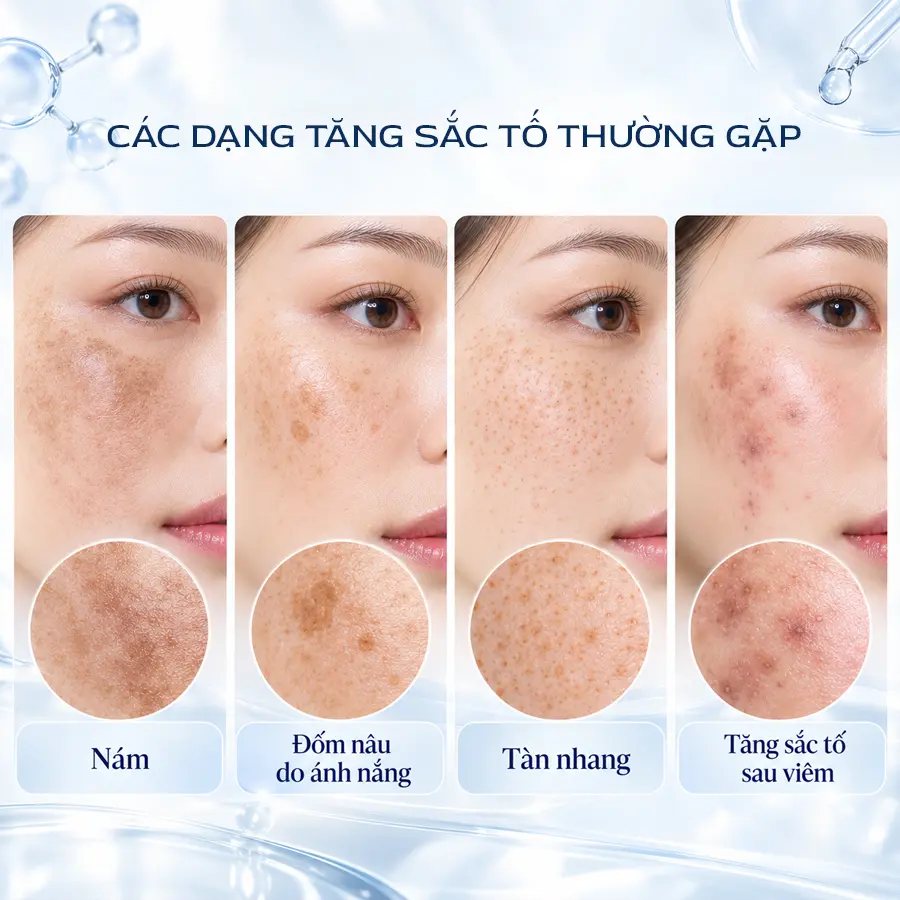 4 Dang Tang Sac To Thuong Gap