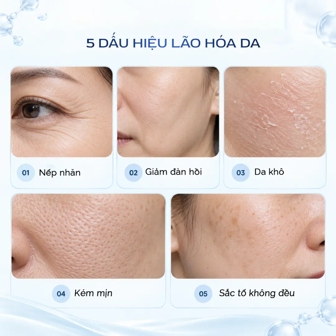 5 Dau Hieu Lao Hoa Da